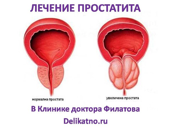 Как быстро снять симптомы простатита Обсуждения - Беременность. Если забеременеть стало проблемой.... - Группы Мой Ми