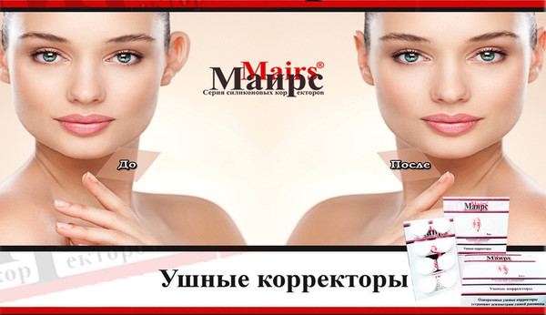 лопоухость как исправить без операции